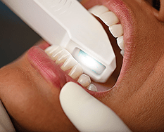 digital dental impressions scanner | Greenwich CT Dentist | Greenwich Cosmetic Dentistry