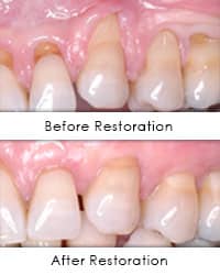 Greenwich Cosmetic Dentistry Oral Plastic Surgery