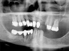 Dental XRay | Greenwich CT Dentist | Greenwich Cosmetic Dentistry