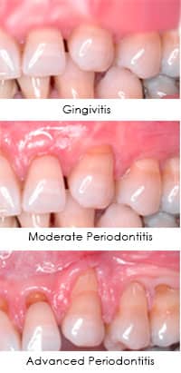 Dental Periodintic Exam image