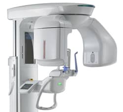 3D Dental Scanner