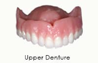 Upper Denture in Greenwich CT